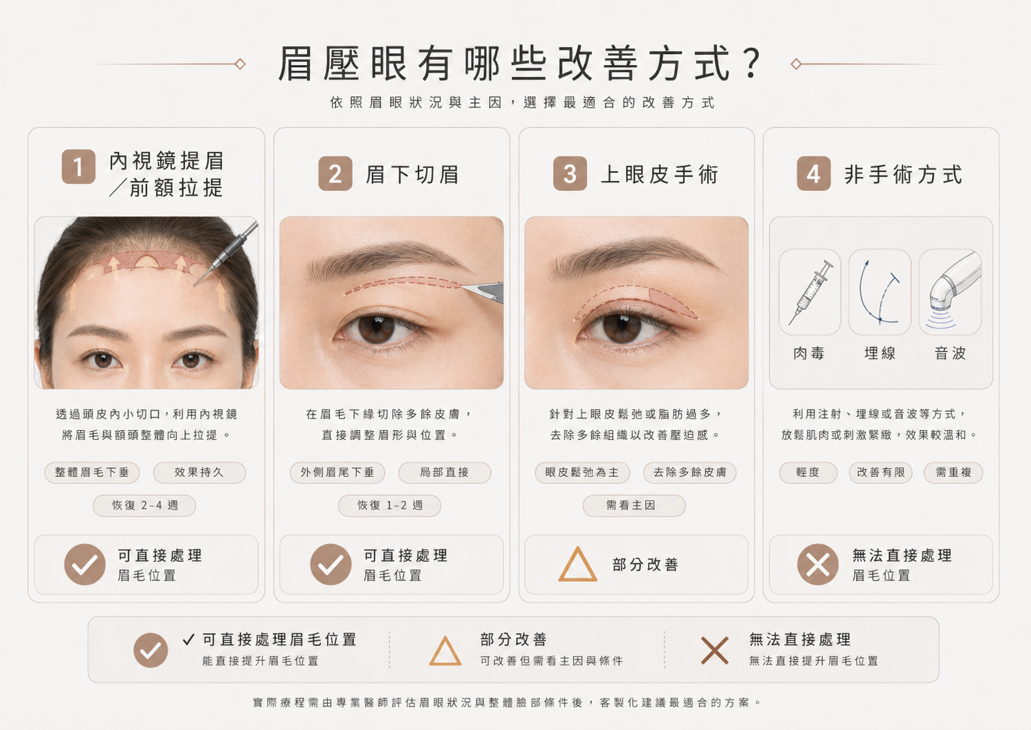 眉壓眼改善方式總覽圖，介紹內視鏡提眉眉下切眉上眼皮手術與非手術方式
