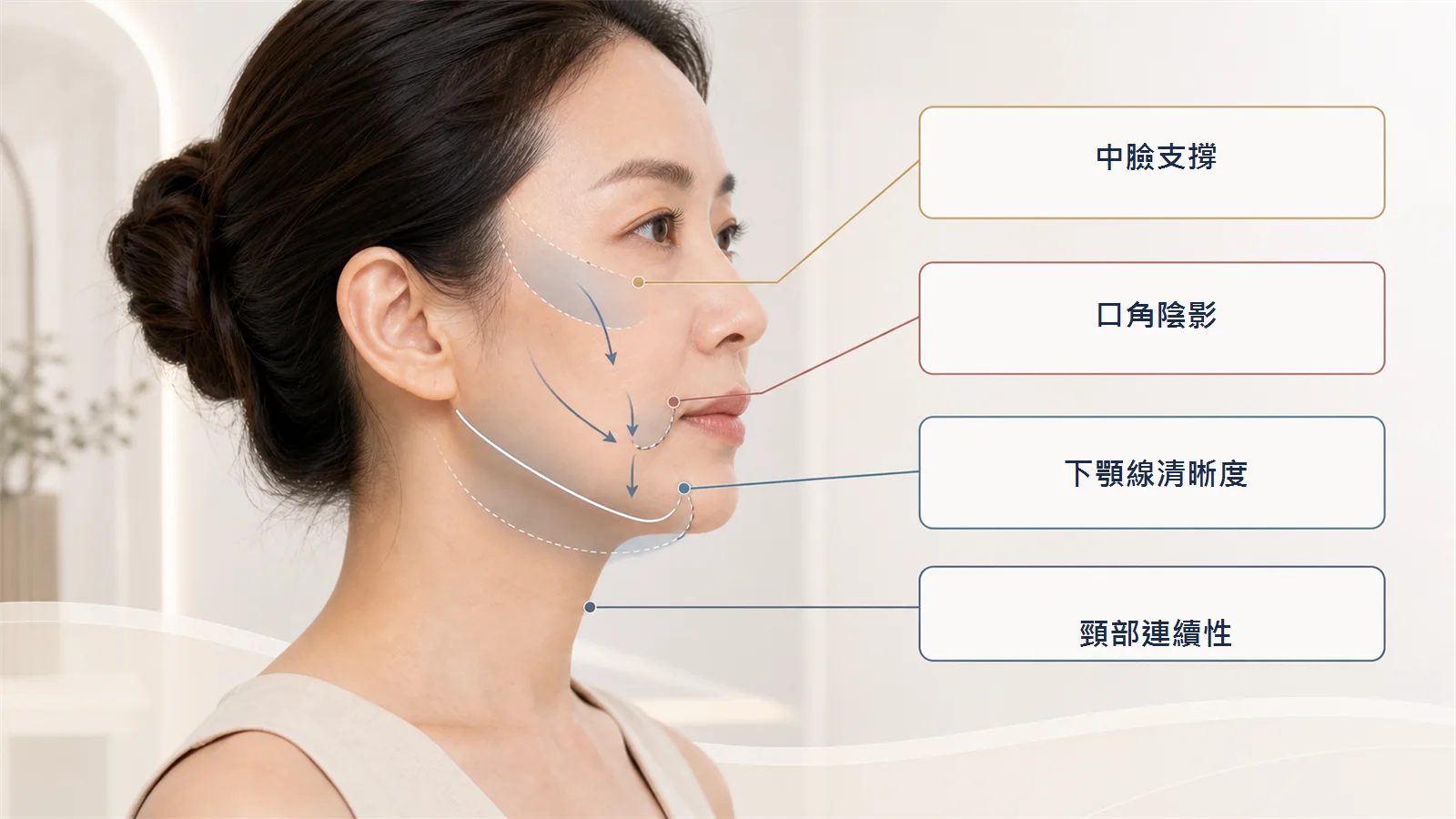 中下臉支撐與嘴邊肉關係圖，說明中臉支撐、口角陰影、下顎線與頸部連續性