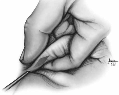 手術中，醫生用手持工具進行精細操作。｜377