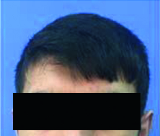 論文圖片：一名男子的頭部照片（766）