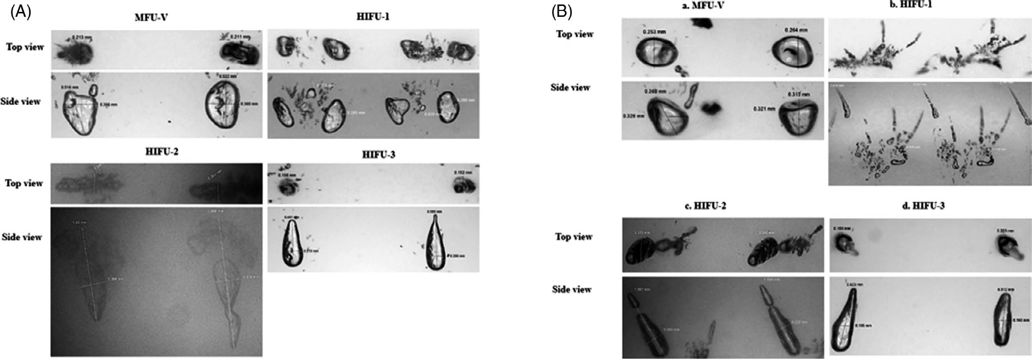 論文圖片：(A) MPFU-V, HIFU-1, HIFU-2, HIFU-3 top and side views. (B) a. MPFU-V, b. HIFU-1, c. HIFU-2, d. HIFU-3 top and side views.（824）