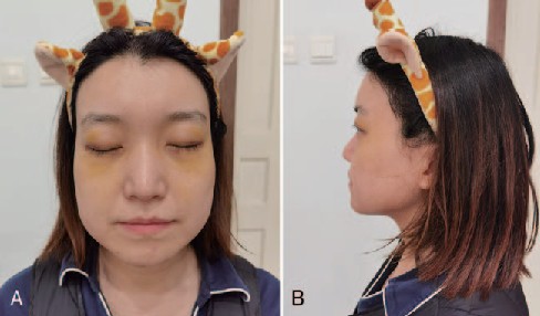 女子戴髮箍,眼下有明顯瘀青。|951